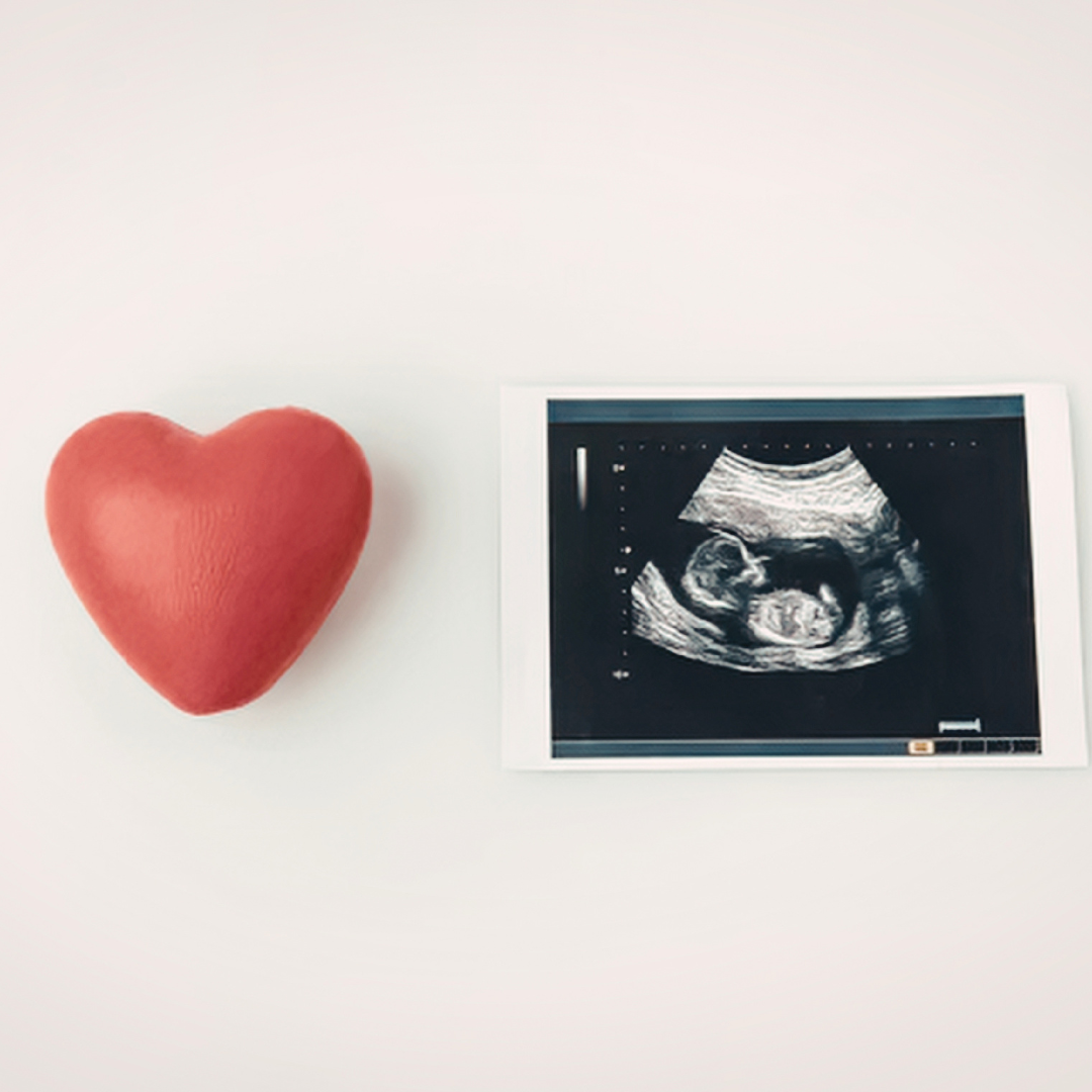 Grief expressed as anger — understanding secondary emotions in TFMR