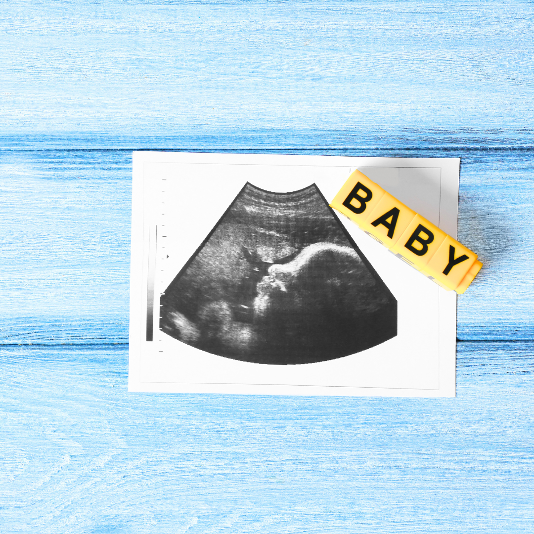 TFMR grief — the weight of ending a wanted pregnancy