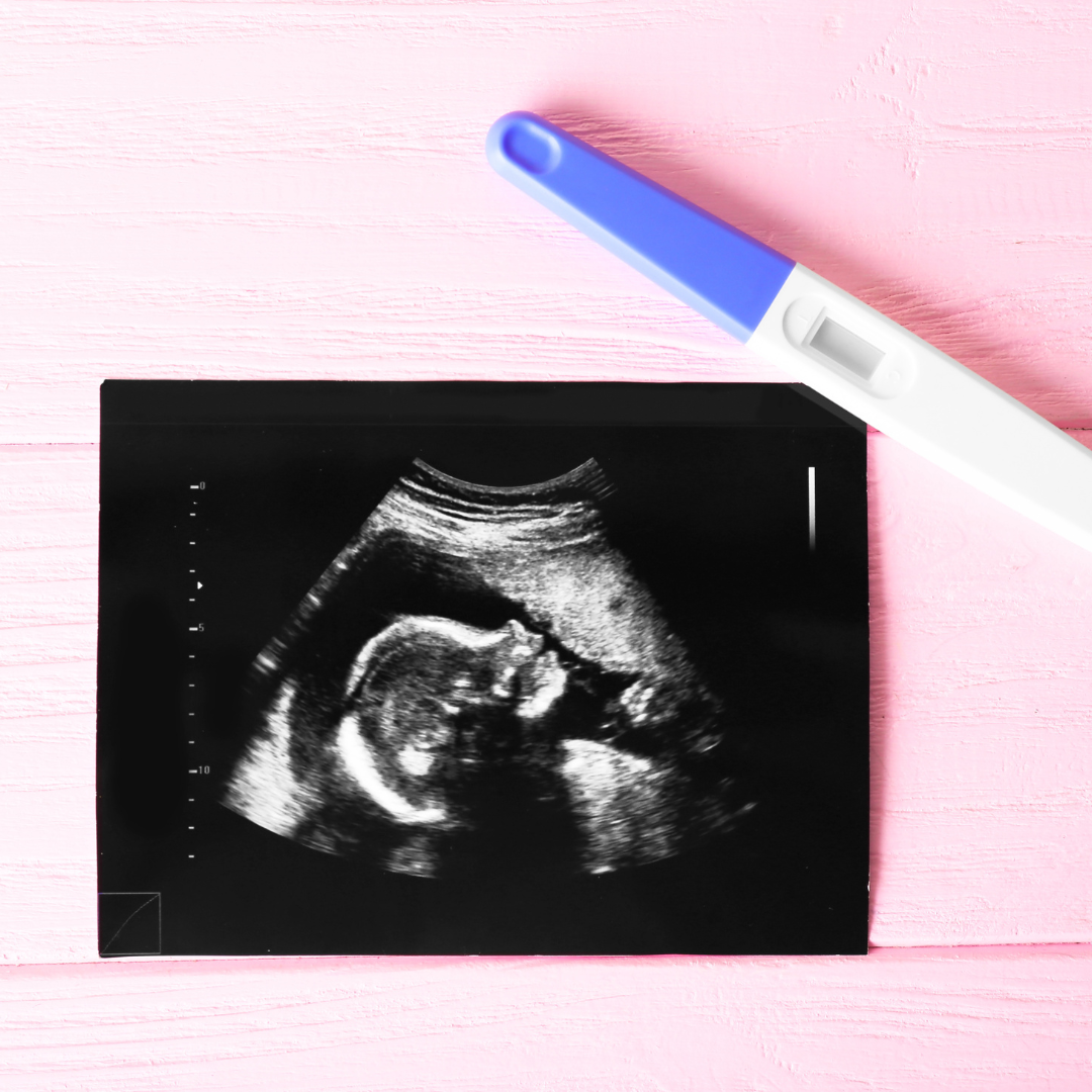 TFMR support Singapore — grief after termination for medical reasons